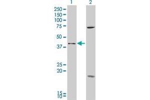 Lane 1: SFRP4 transfected lysate ( 40 KDa).