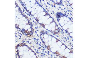 Immunohistochemistry of paraffin-embedded Human colon using CF Rabbit pAb (ABIN7266399) at dilution of 1:100 (40x lens). (CFAP61 抗体)