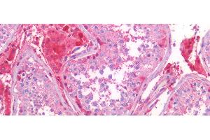 Detection of S100A6 in Human Testis Tissue using Polyclonal Antibody to S100 Calcium Binding Protein A6 (S100A6) (S100A6 抗体  (AA 1-90))