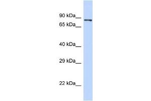 Host:  Rabbit  Target Name:  PIEZO2  Sample Type:  293T Whole Cell lysates  Antibody Dilution:  1. (PIEZO2 抗体  (N-Term))