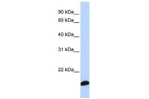 PRDX5 antibody used at 1 ug/ml to detect target protein. (Peroxiredoxin 5 抗体  (Middle Region))