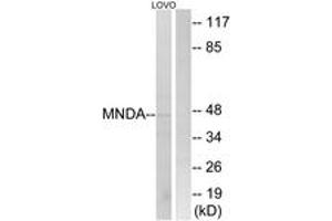 Western Blotting (WB) image for anti-Myeloid Cell Nuclear Differentiation Antigen (MNDA) (AA 358-407) antibody (ABIN2890426) (MNDA 抗体  (AA 358-407))