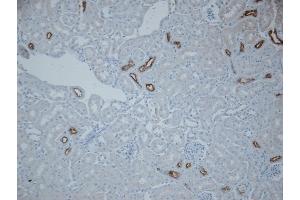 Immunohistochemistry (IHC) image for anti-Solute Carrier Family 12 (Sodium/Chloride Transporters), Member 3 (SLC12A3) (AA 74-95) antibody (APC) (ABIN2486291)