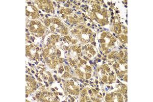 Immunohistochemistry of paraffin-embedded human gastric using HSPE1 antibody at dilution of 1:100 (x400 lens). (HSPE1 抗体)