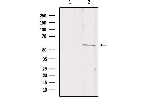 Western blot analysis of extracts from mouse brain, using SLC16A2 Antibody.