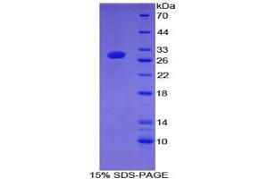 SDS-PAGE analysis of Mouse Coagulation Factor XII Protein. (F12 蛋白)