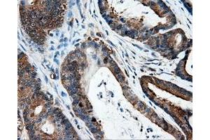Immunohistochemical staining of paraffin-embedded Kidney tissue using anti-IFT57mouse monoclonal antibody. (IFT57 抗体)