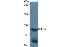 Detection of HIF1a in Human Serum using Polyclonal Antibody to Hypoxia Inducible Factor 1 Alpha (HIF1a) (HIF1A 抗体  (AA 218-506))