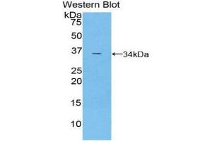 Western Blotting (WB) image for anti-TNF Receptor-Associated Factor 5 (TRAF5) (AA 181-437) antibody (ABIN3203226) (TRAF5 抗体  (AA 181-437))