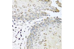 Immunohistochemistry of paraffin-embedded human esophagus using IL6 antibody at dilution of 1:100 (40x lens). (IL-6 抗体)