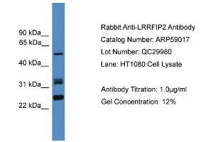 WB Suggested Anti-LRRFIP2  Antibody Titration: 0. (LRRFIP2 抗体  (N-Term))