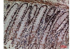 Immunohistochemistry (IHC) analysis of paraffin-embedded Human Colon, antibody was diluted at 1:100. (MCM3 抗体  (Internal Region))
