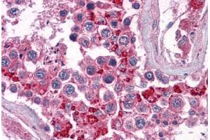 Human Testis: Formalin-Fixed, Paraffin-Embedded (FFPE) (BIRC3 抗体  (AA 314-508))