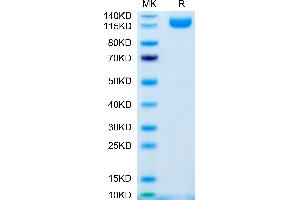 SDS-PAGE (SDS) image for Interleukin 31 Receptor A (IL31RA) (AA 20-519) protein (Fc Tag) (ABIN7275030)