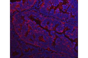 IF analysis of FASN using anti-FASN antibody (ABIN3044520). (Fatty Acid Synthase 抗体  (AA 1-226))