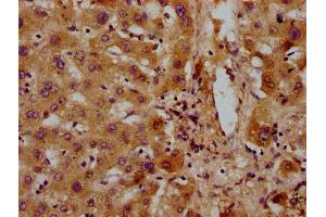 IHC image of ABIN7154041 diluted at 1:300 and staining in paraffin-embedded human liver tissue performed on a Leica BondTM system. (PET112L 抗体  (AA 301-383))
