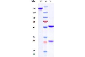 Anti- Human TSLP( Tezepelumab) on SDS-PAGE under reducing (R) condition. (Recombinant TSLP (Tezepelumab Biosimilar) 抗体)