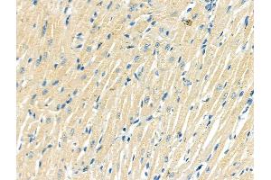 ABIN6262610 and ABIN6268748 at 1/100 staining Rat heart tissue by IHC-P.