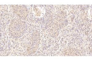 Detection of CDH23 in Human Spleen Tissue using Polyclonal Antibody to Cadherin 23 (CDH23) (CDH23 抗体  (AA 34-236))