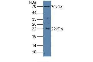 Detection of IL1RAP in Human Serum using Polyclonal Antibody to Interleukin 1 Receptor Accessory Protein (IL1RAP) (IL1RAP 抗体  (AA 420-558))