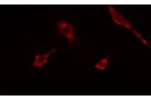ABIN6268898 staining COLO205  cells by IF/ICC. (ACTG2 抗体  (N-Term))