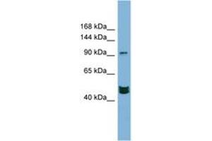 Image no. 1 for anti-Mastermind-Like 3 (MAML3) (AA 791-840) antibody (ABIN6742125) (MAML3 抗体  (AA 791-840))