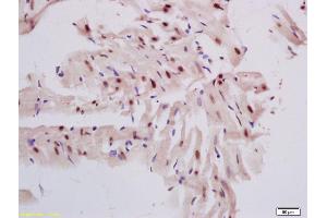 Formalin-fixed and paraffin embedded rat heart labeled with Rabbit Anti DNase gamma Polyclonal Antibody, Unconjugated (ABIN872726) at 1:200 followed by conjugation to the secondary antibody and DAB staining (DNASE1L3 抗体  (AA 151-250))