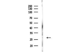 Western blot analysis of lysates from COLO205 cells, using MOBKL1B Antibody at 1/1000 dilution.