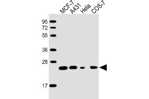 All lanes : Anti-RAB21 Antibody at 1:2000 dilution Lane 1: MCF-7 whole cell lysate Lane 2: A431 whole cell lysate Lane 3: Hela whole cell lysate Lane 4: COS-7 whole cell lysate Lysates/proteins at 20 μg per lane. (RAB21 抗体  (AA 1-225))