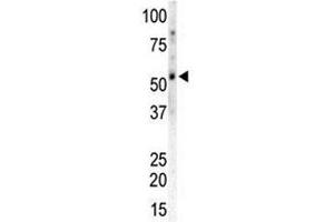Western Blotting (WB) image for anti-Calcium/calmodulin-Dependent Protein Kinase II gamma (CAMK2G) (AA 309-338) antibody (ABIN3030258)