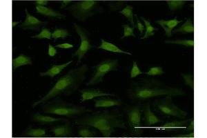 Immunofluorescence of monoclonal antibody to HEXIM1 on HeLa cell. (HEXIM1 抗体  (AA 1-359))