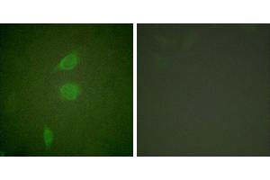Peptide - +Immunofluorescence analysis of NIH/3T3 cells, using HDAC5 antibody (#C0225). (HDAC5 抗体)