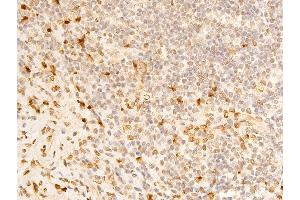 ABIN6267273 at 1/100 staining human appendiceal tissue sections by IHC-P. (Lamin A/C 抗体  (pSer392))
