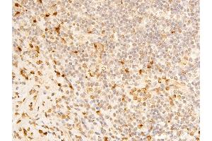 ABIN6267273 at 1/100 staining human appendiceal tissue sections by IHC-P. (Lamin A/C 抗体  (pSer392))