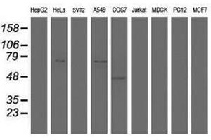 Image no. 1 for anti-HBS1-Like (HBS1L) (AA 1-260) antibody (ABIN1490655) (HBS1L 抗体  (AA 1-260))