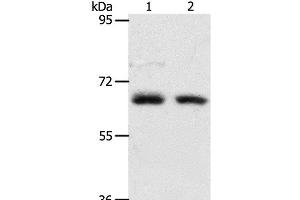 Western Blot analysis of Human fetal kidney and fetal lung tissue using ACOT11 Polyclonal Antibody at dilution of 1:450 (ACOT11 抗体)