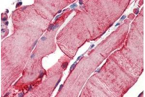 Human Skeletal Muscle (formalin-fixed, paraffin-embedded) stained with Heat Shock Protein 27 (HSP27) antibody ABIN462101 at 10 ug/ml followed by biotinylated goat anti-rabbit IgG secondary antibody ABIN481713, alkaline phosphatase-streptavidin and chromogen. (HSP27 抗体)