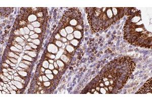 ABIN6272972 at 1/100 staining Mouse colon tissue by IHC-P. (OSBP 抗体  (Internal Region))