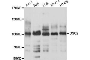 Western blot analysis of extract of various cells, using DSC2 antibody. (Desmocollin 2 抗体)
