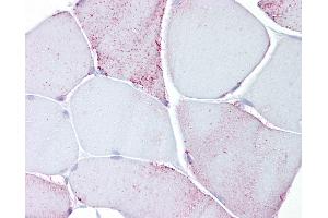 Anti-PYGM / Phosphorylase b antibody IHC of human skeletal muscle. (PYGM 抗体  (AA 698-727))