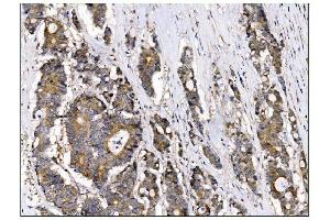 IHC analysis of AS160/TBC1D4 using anti-AS160/TBC1D4 antibody (ABIN7599745). (TBC1D4 抗体  (AA 1118-1298))
