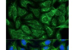 Immunofluorescence (IF) image for anti-Methylenetetrahydrofolate Dehydrogenase (NADP+ Dependent) 2, Methenyltetrahydrofolate Cyclohydrolase (MTHFD2) antibody (ABIN7255295)