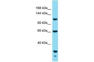 Western Blotting (WB) image for anti-KIAA1522 (KIAA1522) (C-Term) antibody (ABIN2791616) (KIAA1522 抗体  (C-Term))
