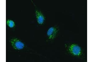 IF analysis of TRK fused gene/TFG using anti-TRK fused gene/TFG antibody (ABIN7599839). (TFG 抗体  (AA 121-400))