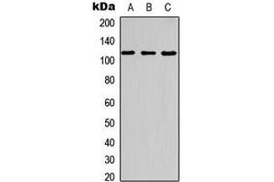 Western blot analysis of c-CBL (pY700) expression in HT29 UV-treated (A), NIH3T3 (B), rat kidney (C) whole cell lysates. (CBL 抗体  (C-Term, pTyr700))