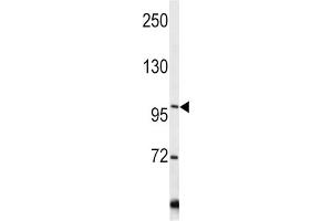 Western Blotting (WB) image for anti-Collagen, Type VI, alpha 1 (COL6A1) antibody (ABIN3002700) (COL6A1 抗体)