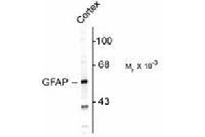 Image no. 1 for anti-Glial Fibrillary Acidic Protein (GFAP) antibody (ABIN303954) (GFAP 抗体)