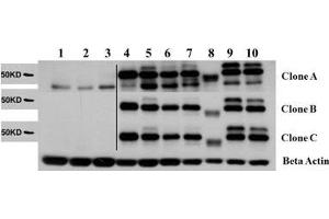 V-Akt Murine Thymoma Viral Oncogene Homolog 2 (AKT2) peptide