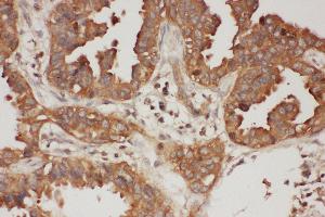 Immunohistochemistry (IHC) image for anti-Calpain 1, Large Subunit (CAPNL1) (AA 312-326), (Middle Region) antibody (ABIN3044292)