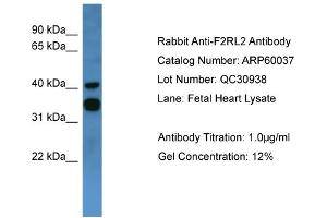 WB Suggested Anti-F2RL2  Antibody Titration: 0. (F2RL2 抗体  (C-Term))